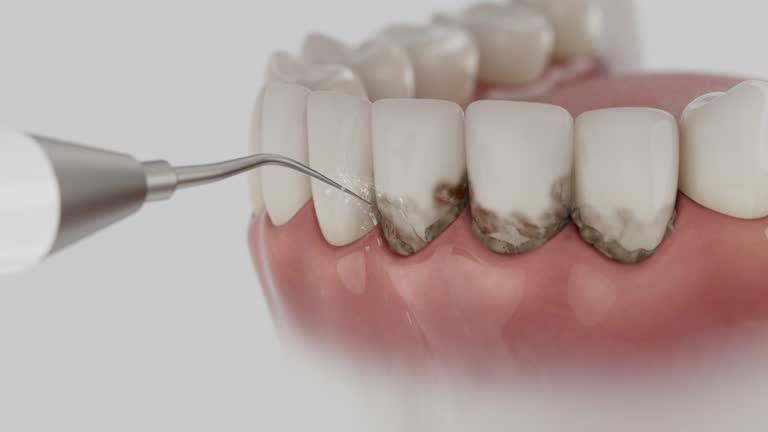 Trusted Tooth Extraction service in Wiggins, MS - Dentist Open Now